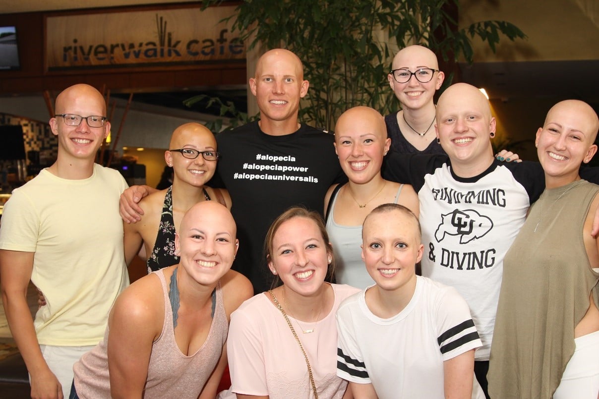 Casey McCreath's fundraising page for National Alopecia Areata Foundation