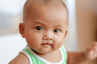 A Chinese baby boy with cleft lip looks intently at a camera. He wears a sleeveless white and green shirt.