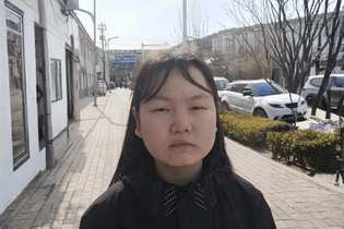 A teenage girl with a cleft need from China stands on the sidewalk in the sun. She wears a black shirt and looks somberly at the camera.