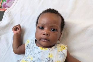 A little Ugandan baby girl lays on clean white bedsheets. She wears a dress with yellow flowers. She looks at the camera with furrowed eyebrows.