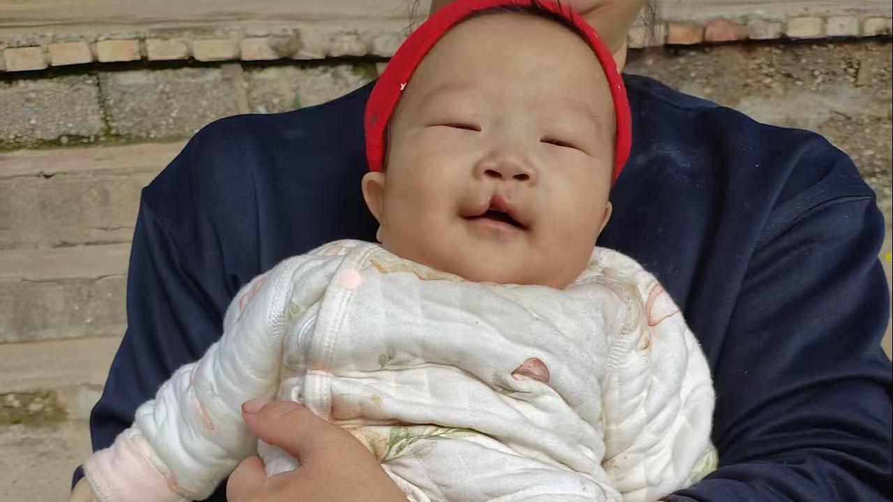 Louis is in the arms of his parent with his eyes slightly closed and a small smile on his face.  He has a unilateral cleft lip on the left side.